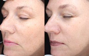 jan marini skin care