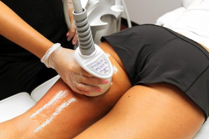 Cellulite Reduction scaled