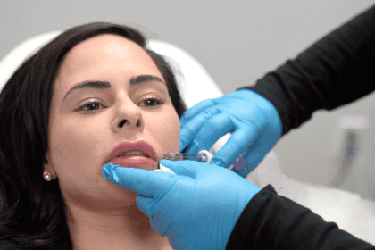 dermal filler
