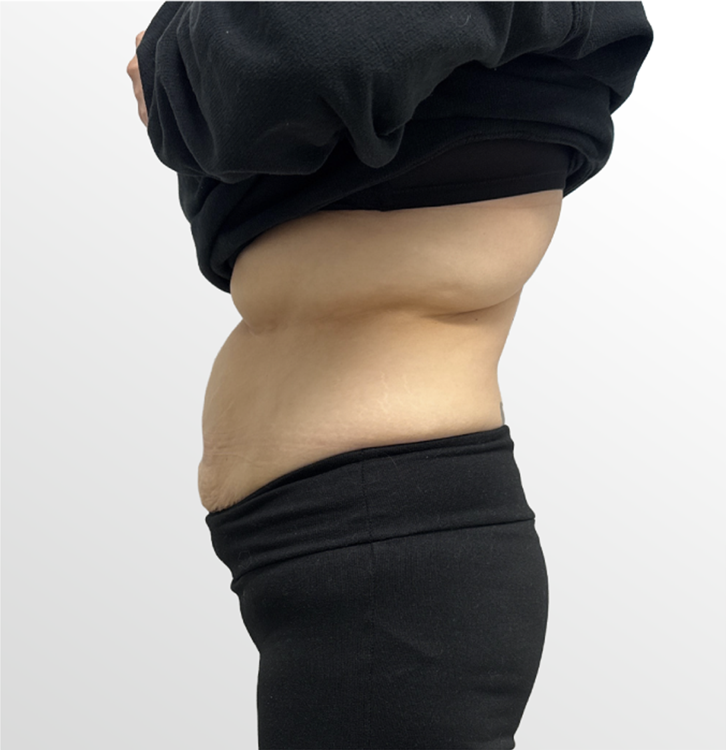 mebership body after