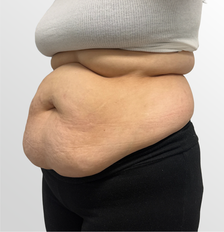 mebership body before