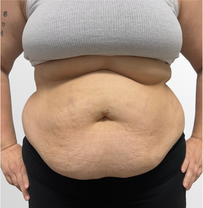 mebership glp before