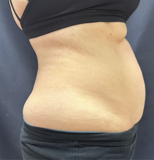 mebership glp2 before