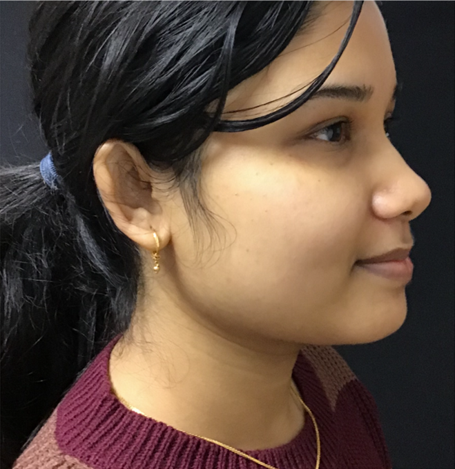 membership after image