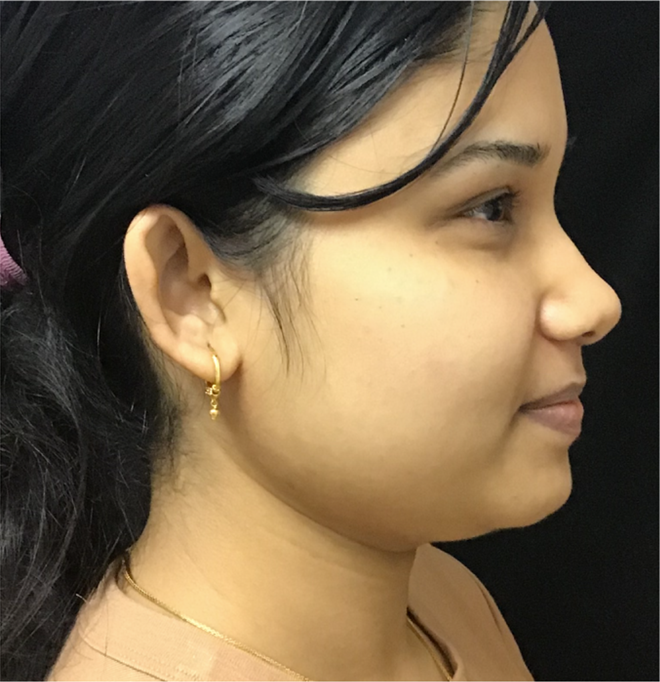 membership before image